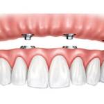 Turismo Dentale DENTALE ALBANIA Profile Picture